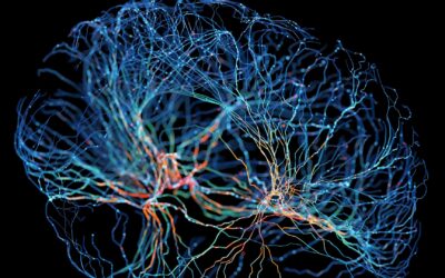 Breakthrough Gene Therapy Becomes First to Slow Progression of Huntington’s Disease